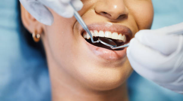Best Emergency Dental Care for Sports Injuries in Mariposa, CA